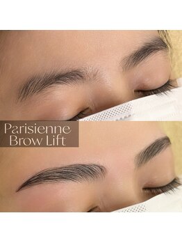 スカイ(Sky)/ブロウリフト