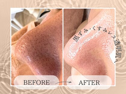 ルミナス(luminous)の写真