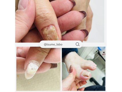 ネイルエキスパートプラス(ネイルエキスパート+)の写真