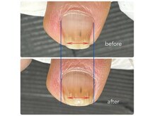 ルアルネイル(Luar nail)の雰囲気（歩くのがラクに!巻き爪改善ケアbyヘイスイッチ）