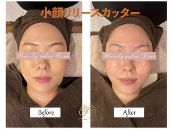 リノ(Lino)/別人級♪