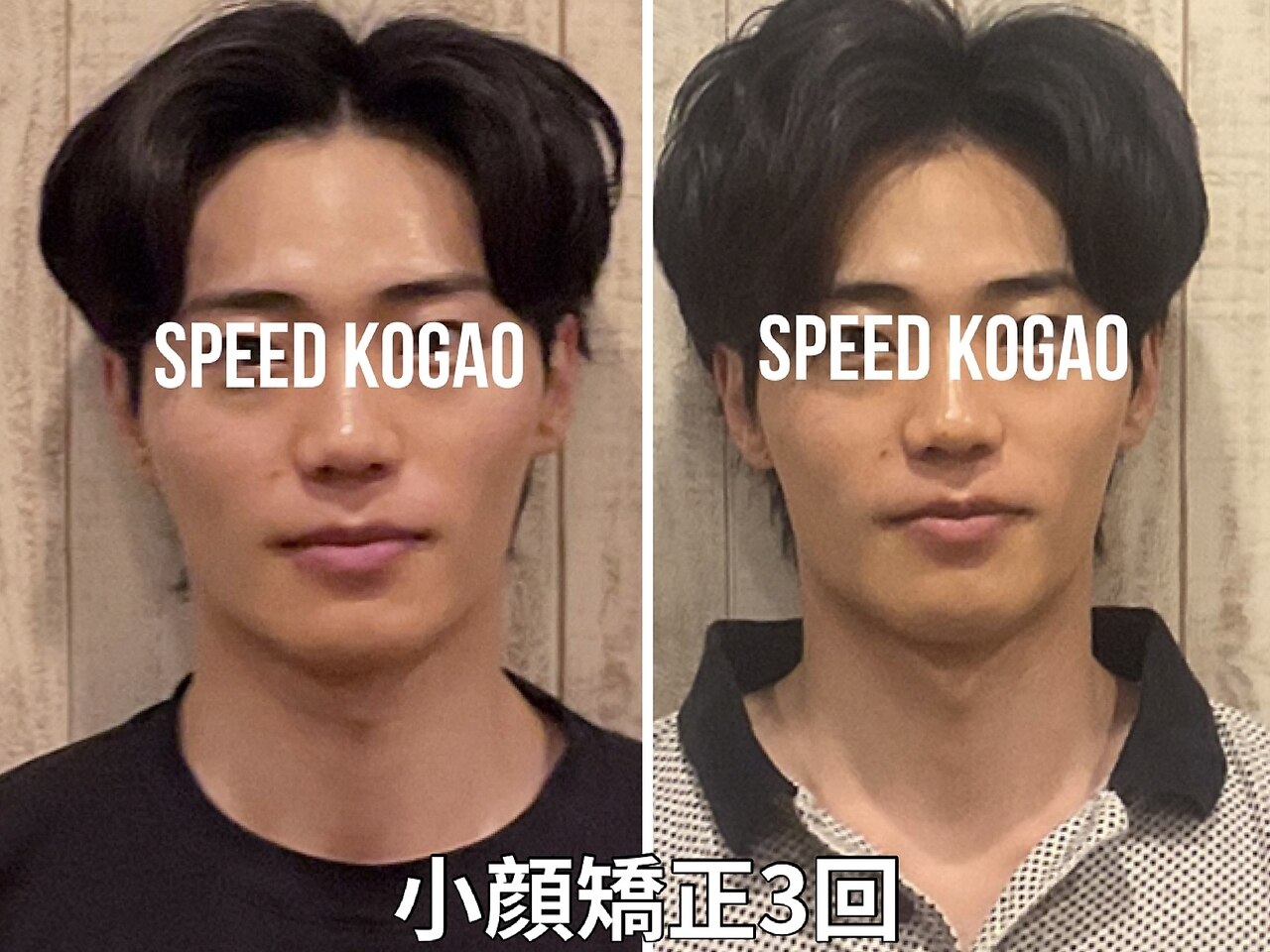 スピード小顔 渋谷店 (Speed)｜ホットペッパービューティー