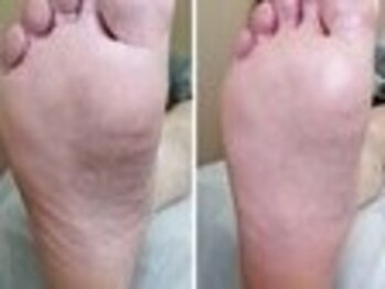 リゼラアンドコー 名古屋栄店【フットケア/巻き爪/足裏角質/爪トラブル】/