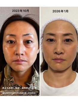 リレフー(Relafy)/★美肌★