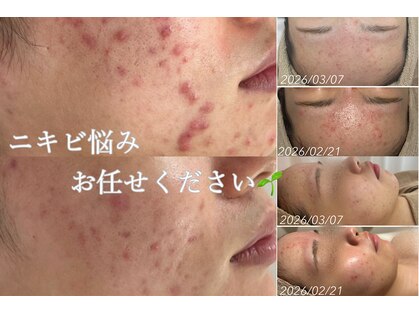 アンリミット 渋谷宮益坂店(Une limit)の写真