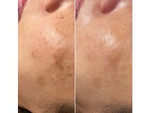 ル ボヌールの雰囲気(最新光マシーン新たに導入♪スピーディーな結果出しを目指します)