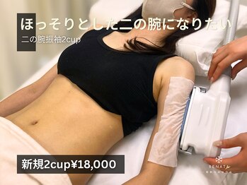レナータ 銀座店(RENATA)/二の腕２カップ脂肪冷却