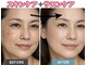 ヴィーナスハンドの写真/歴18年の凄腕オーナーがお肌もお体もお悩みを根本改善！整体師エステで、あらゆるお悩みに徹底アプローチ☆