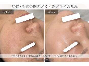 サロン ド ビューティージュエル(salon de beauty JEWEL)の写真/40代から目立ち始めるたるみ毛穴・くすみ。本気で変えたい方へ
