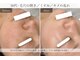 サロン ド ビューティージュエル(salon de beauty JEWEL)の写真/40代から目立ち始めるたるみ毛穴・くすみ。本気で変えたい方へ