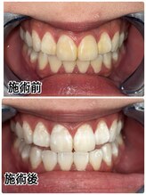 ホワイトニングビューティー 名古屋栄店(WHITENING BEAUTY)/セルフホワイトニング