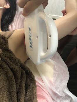 ドクターアリィ(Dr.ALII)/施術風景3レディース脇脱毛