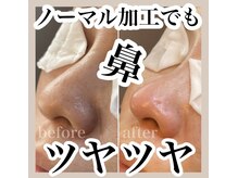 ワイグレイス(Y.GRACE)の雰囲気（【劇的！毛穴改善】毛穴エクストラクションプロ★毛穴レス陶器肌）