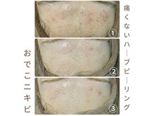 ルアナアイナ 池袋店(Luana Aina)の雰囲気（ニキビケアでお悩みの方は是非一度ルアナアイナ池袋店へ♪[池袋]）