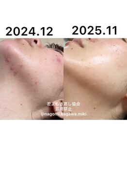 リレフー(Relafy)/★美肌★