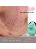 [5月]お顔ザラザラしていませか？毛穴詰まりを除去!!～毛穴洗浄～¥12,000-