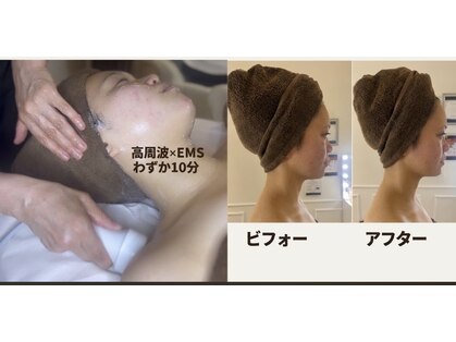 ビ フェイス(Bi-face)の写真