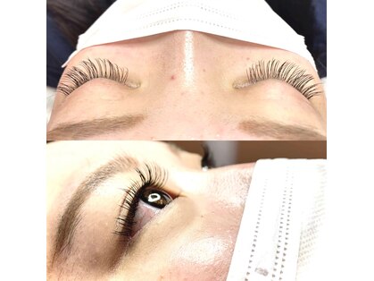 アンクラピス(AnkLapis)の写真