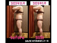 ドルチェヴィータ(DOLCE VITA)/痩身モニター様　途中経過