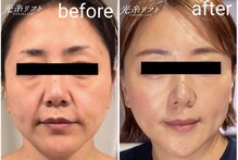 プチボヌール(petit bonheur)