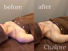 シャロレ(Chalore)の雰囲気（リピーター様続出♪様々なバスト悩みを解消！理想のバストが叶う）