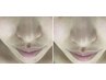 【韓国美肌WAX】ツヤ肌爆誕！！！毛穴レスな肌へ*保湿パック付き！ 5700円