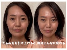 エンジェルエッグ
