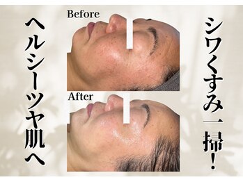 リリーシャ 赤坂(LILISHA)/50代の肌悩みを全て一掃!