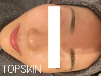トップスキン 新宿(TOPSKIN)/TCLINE取り扱いはTOPSKINだけ!
