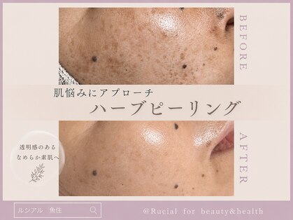 ルシアル(Rucial)の写真