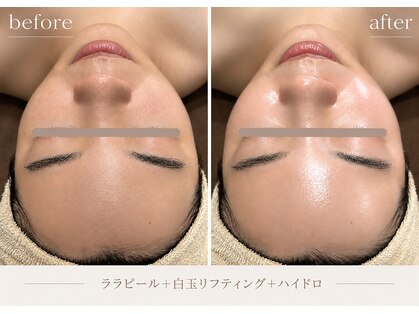 ディースズ(D.suzu)の写真