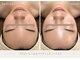 ディースズ(D.suzu)の写真