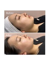 ホワイトワックス 京都四条烏丸(WHITE WAX)/《全顔》フェイシャルワックス