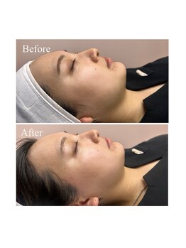 ホワイトワックス 京都四条烏丸(WHITE WAX)/《全顔》フェイシャルワックス