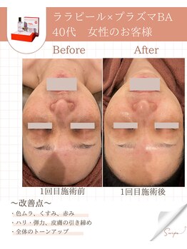 ミーカラー(mecalla.)/ララピール×プラズマBA