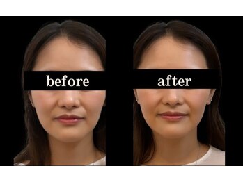 ソナ 大和西大寺院(SONA)/