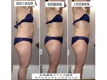 久遠(kuon)/痩身ラフォス＋デトックスリンパ
