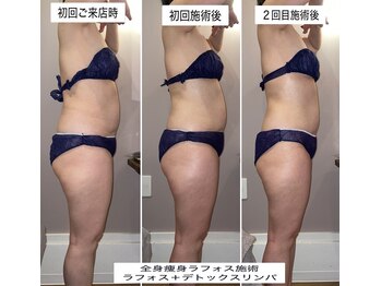 久遠(kuon)/痩身ラフォス+デトックスリンパ