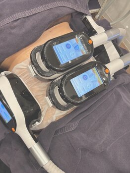セルティビューティーサロン(CELTY)の写真/「気になる浮き輪肉に集中２CUP」「４CUPでお腹の贅肉徹底駆逐」理想に合わせて部位もCUP数もカスタム自由!