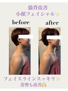 ファブ(Fab)/猫背改善