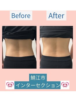 腰の整体インターセクション/美容整体