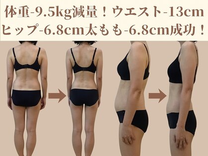 エターナルフレーム(Eternal Flame)の写真