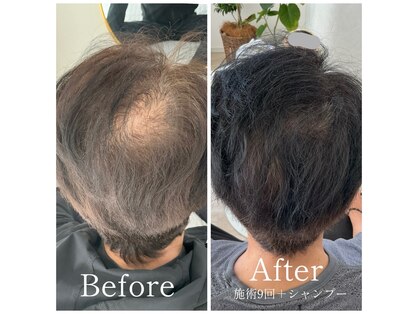 マーブル 熊本合志店の写真