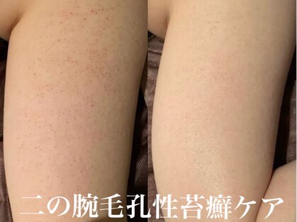 ルアナアイナ(Luana Aina)の写真