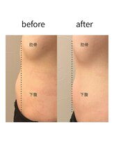 ソノ(sono)/腸もみメニュー