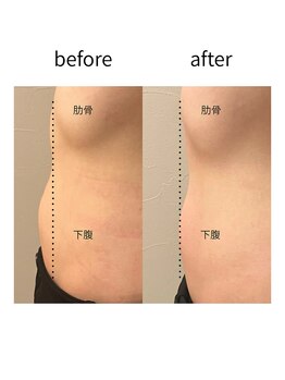 ソノ(sono)/腸もみメニュー