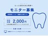 10名様限定☆高濃度ジェル(過酸化水素入り)/ホワイトニングモニター募集