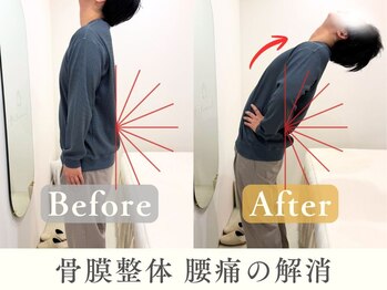 ヒラメント 桜新町(Hilament)/腰痛ビフォーアフター〈整体〉