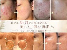 アイデアル(AiDEAL)