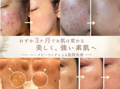 アイデアル(AiDEAL)の写真